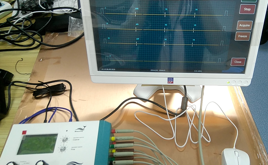 Figure 6a – ECG Device Sample Tested by CMRR – Allion Labs